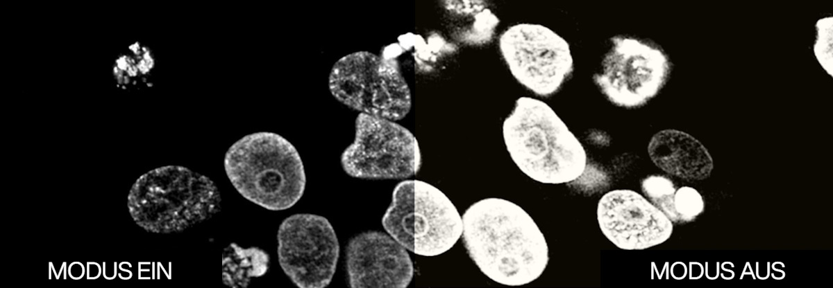 Vergleich von DICOM Modus ein und Modus aus